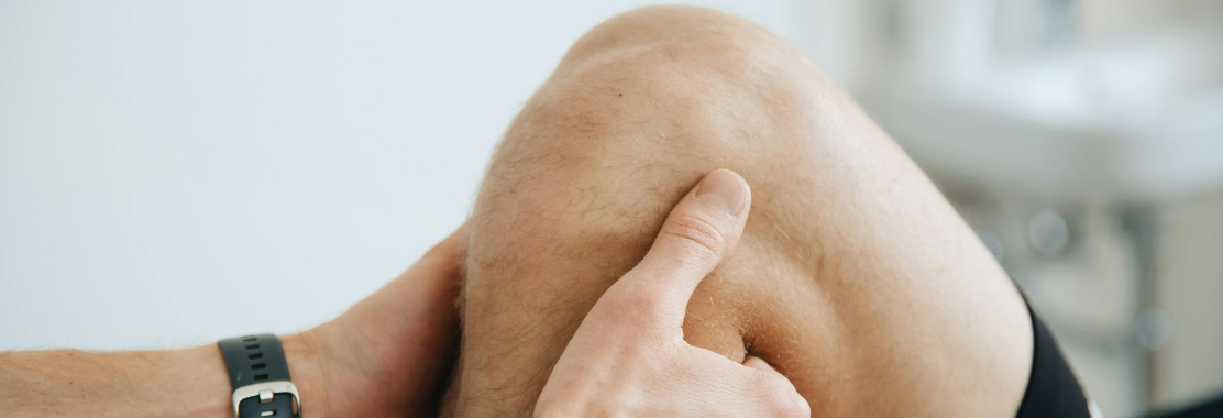 Gęsia stopka zapalenie gęsiej stopki – przyczyny, rehabilitacja i leczenie